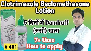 Candid B lotion  Candid B lotion for hair dandruff  Clotrimazole beclomethasone lotion [upl. by Odell]