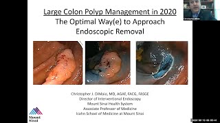 How long does it take to recover from a polyp removal  Dr Shanthala Thuppanna [upl. by Odnamla30]