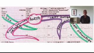 10 Step Method for 12 lead ECG interpretation [upl. by Hannibal]