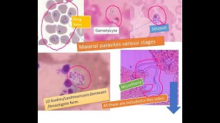 Most common Blood parasites [upl. by Vitia]