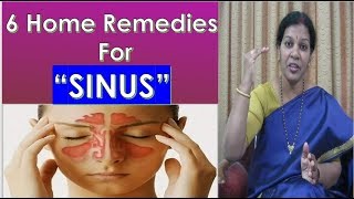 6 Home Remedies To Get Rid of quotSinusquot [upl. by Noirda838]