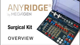 The New AnyRidge Sx Kit Overview [upl. by Childs642]