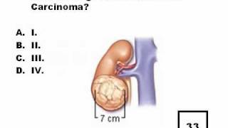 RENAL ULTRASOUND QUESTIONS 3wmv [upl. by Anohsal]