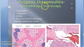 Pathology 825 g Pyogenic Osteomyelitis Morphology Microscopy [upl. by Aerdnwahs]