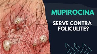 POMADA MUPIROCINA SERVE CONTRA FOLICULITE  DESCUBRA [upl. by Cecilius375]