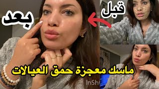 عاجل🚨 تبييض تلميع البشرة في ساعة واحدة ✅😱ب 3 مكونات في مطبخك تبييض [upl. by Liddy417]