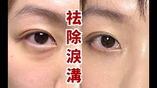 0成本按摩去淚溝眼袋  不醫美！告別遮瑕 日本爆火去淚溝按摩法來了 [upl. by Sukram]