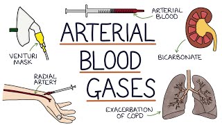 Understanding Arterial Blood Gases [upl. by Adamsen423]