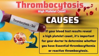 THROMBOCYTOSIS OR High Platelet Count  Cause  Symptoms  Complications  Treatment [upl. by Matrona430]