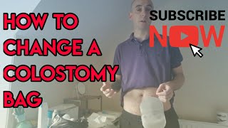 How to change a colostomy stoma bag [upl. by Nagap]