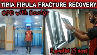 tibia fibula fracture recovery my journey skin grafting today5 months 25 days my recovery [upl. by Alyosha]