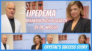 Crystals Lipedema Surgery Success Story Dr Wrights Research Revealed [upl. by Moseley]