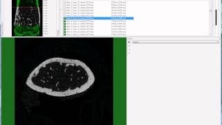 Bruker microCT tutorial Setting the trabecular VOI for the mouse femur [upl. by Lisbeth718]