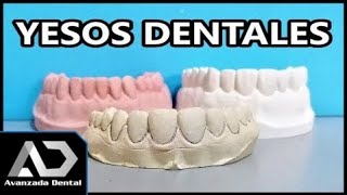 Tipos De Yeso Dentales Odontología miniClase [upl. by Vanthe]