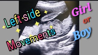 Posterior Placenta With Fetal Heartbeat 130bpm  Left side Baby Movement  27Weeks Baby Genderreveal [upl. by Neved]