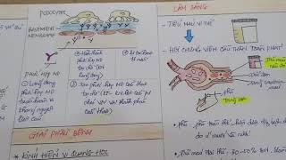 Viêm cầu thận cấp hậu nhiễm liên cầu trùng [upl. by Elleiram]