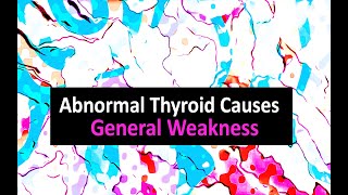 Abnormal Thyroid Causes General Weakness [upl. by Nellda]