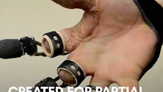 Groundbreaking prosthetic fingers [upl. by Winsor]