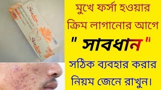 Skinshine Cream Side effects এর কারন  The correct rules for using Skin Shine Cream [upl. by Gaylord]