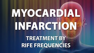 Myocardial Infarction  RIFE Frequencies Treatment  Energy amp Quantum Medicine with Bioresonance [upl. by Kurtz142]