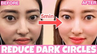 Reduce Dark Circles Wrinkles Under Eyes With This Massage [upl. by Aney]