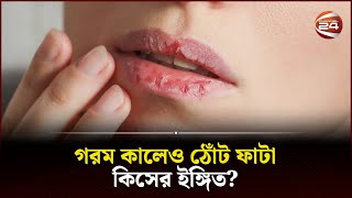 গরম কালেও ঠোঁট ফাটা কিসের ইঙ্গিত  Lip Itchy  Channel 24 [upl. by Wilkins]