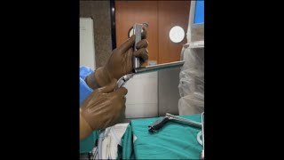 MLS microlaryngoscopy procedure [upl. by Eelynnhoj569]