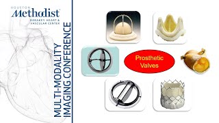 Evaluation of Prosthetic Heart Valves with EchoDoppler Role of CTMRI Zoghbi Chang Shah5322 [upl. by Arbe52]