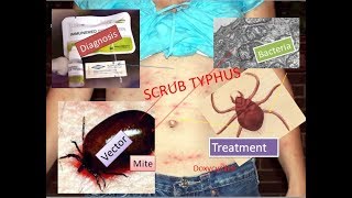 Scrub typhus symptoms diagnosis and protection [upl. by Filberto]