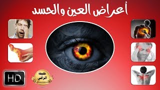 اعراض الإصابة بالعين والحسد  ادخل لتعرف اذا ما كنت مصابا بها [upl. by Gibert]