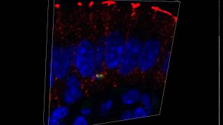 Listeria monocytogenes in Mouse Ileal Tissue [upl. by Ogir280]