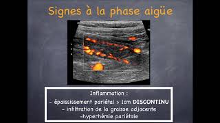 Maladies Inflammatoires Chroniques de lIntestin  2 Crohn amp Rectocolite Hémorragique [upl. by Martineau]