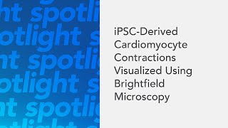 iPSCDerived Cardiomyocyte Contractions Visualized Using Brightfield Microscopy [upl. by Elenaj654]