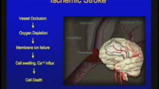 Vascular Disorders of the Central Nervous System [upl. by Rednijar46]