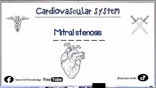 Mitral Stenosis  Murmurs  Cardiovascular system  Urdu Hindi [upl. by Hotchkiss778]