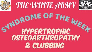 Syndromeoftheweek  Hypertrophic Osteoarthropathy amp Clubbing  THE WHITE ARMY [upl. by Steinway]