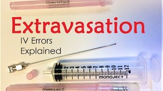 Extravasation  IV Infiltration Errors Explained Doctor Interview [upl. by Ashmead]