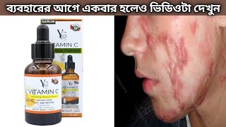 YC Vitamin C Serum  YC Vitamin C Whitening Fairness Serum Review [upl. by Aneev]