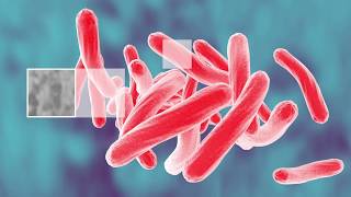 Screening for Latent Tuberculosis Infection LTBI [upl. by Eisenhart186]