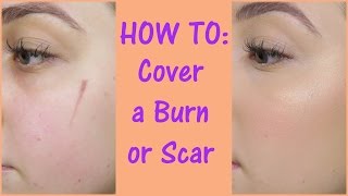 How To Cover A Scar With Makeup [upl. by Zebulon542]