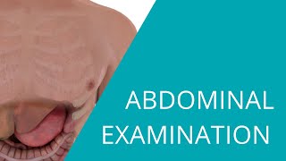 Abdominal Examination  Examination of the abdomen and gastrointestinal system [upl. by Leunas894]