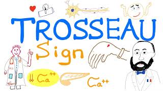 Trosseau Sign  Hypocalcemia  Carpal Spasm  Clinical Medicine [upl. by Sigismondo]