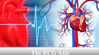 ECG Axis Tutorial Part 4  The Quadrant Method [upl. by Aehtela]