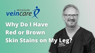 Why Do I Have Red or Brown Skin Stains on My Leg [upl. by Aramot461]