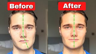 How to Fix Asymmetrical Jaw amp Face TODAY [upl. by Corny]