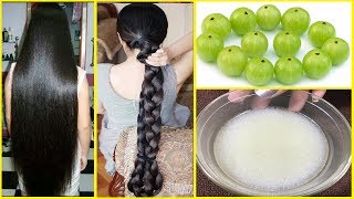 How To Grow Long amp Thicken Hair With Amla  Fast HAIR GROWTH  Stop HAIR LOSS Completely [upl. by Atsillac]