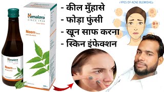 Himalaya Neem Syrup  himalaya neem syrup benefits in hindi  Pimpuls [upl. by Nnyliak472]