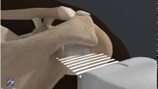 How To Shoulder Glenohumeral Joint 3D Video [upl. by Nylrats145]