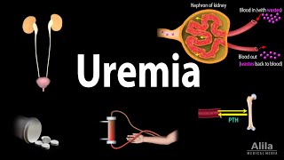 Uremia Pathophysiology Symptoms Diagnosis and Treatment Animation [upl. by Livvy]