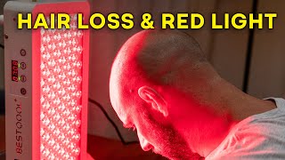 Red Light Therapy For Hair Loss Fountain Of Youth OR [upl. by Gardol]